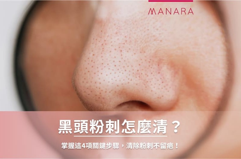 黑頭粉刺怎麼清？鼻頭直冒黑頭粉刺怎麼辦？本文帶你認識黑頭粉刺的成因，破解去黑頭相關5大常見迷思，再告訴你清除粉刺的正確4步驟，最後加碼去黑頭粉刺推薦保養品，助你擊退草莓鼻，找回光滑牛奶肌！